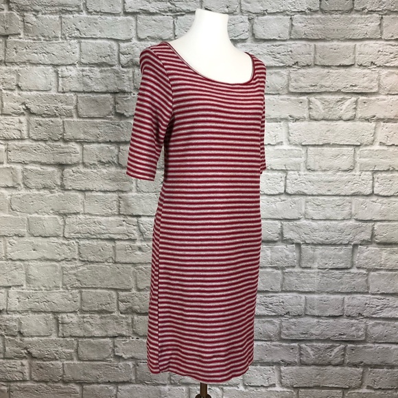 We The Free Frenchie Striped Open Back Dress - Picture 5 of 7